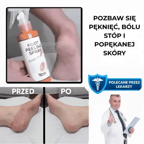 Profesjonalny spray złuszczający FootFresh™